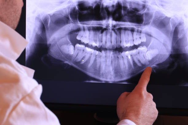 Best Emergency Dental Surgery in Mount Vista, WA