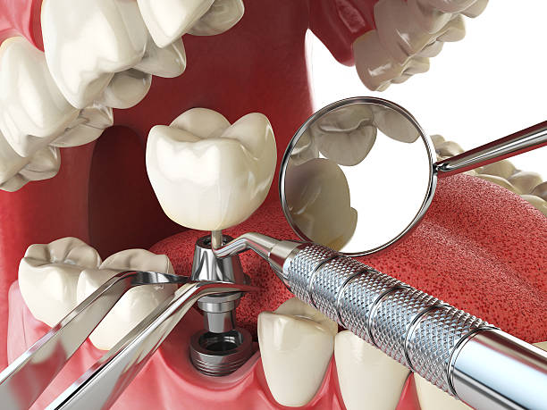 Best Walk-In Emergency Dentist in Mount Vista, WA